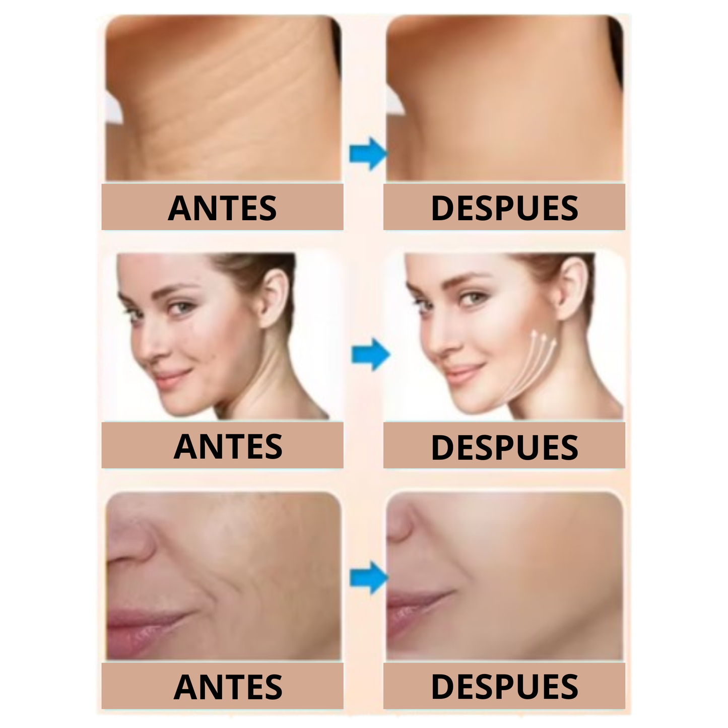 Masajeador Facial Radiofrecuencia - PerfectSkin